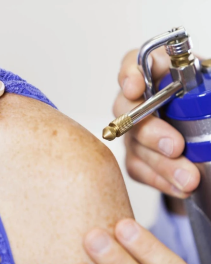 Freeze branding : attention à ce tatouage tendance qui détruit la peau